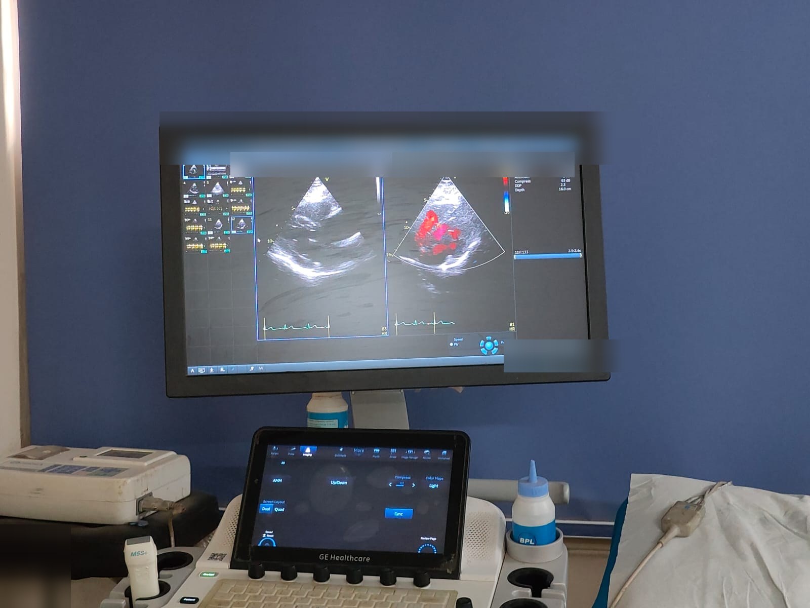 Echocardiography machine at Spandan Heart and Medicare Clinic