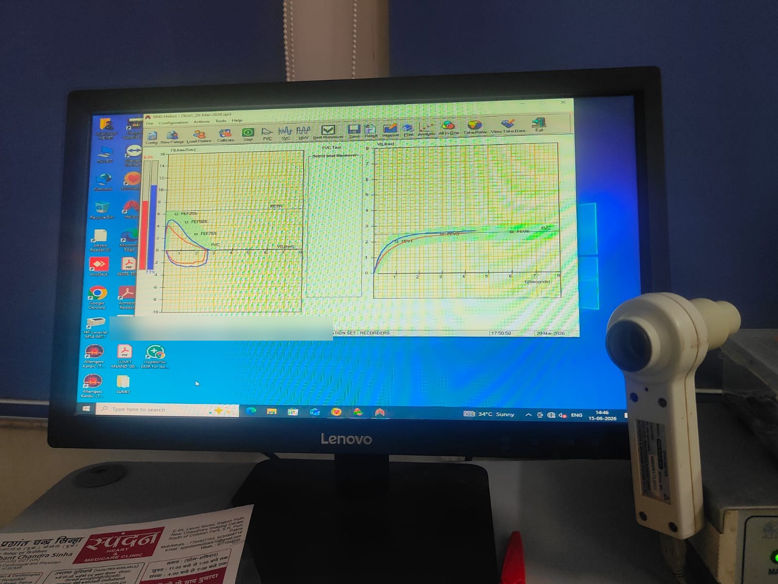 Pulmonary function testing equipment at Spandan Heart and Medicare Clinic