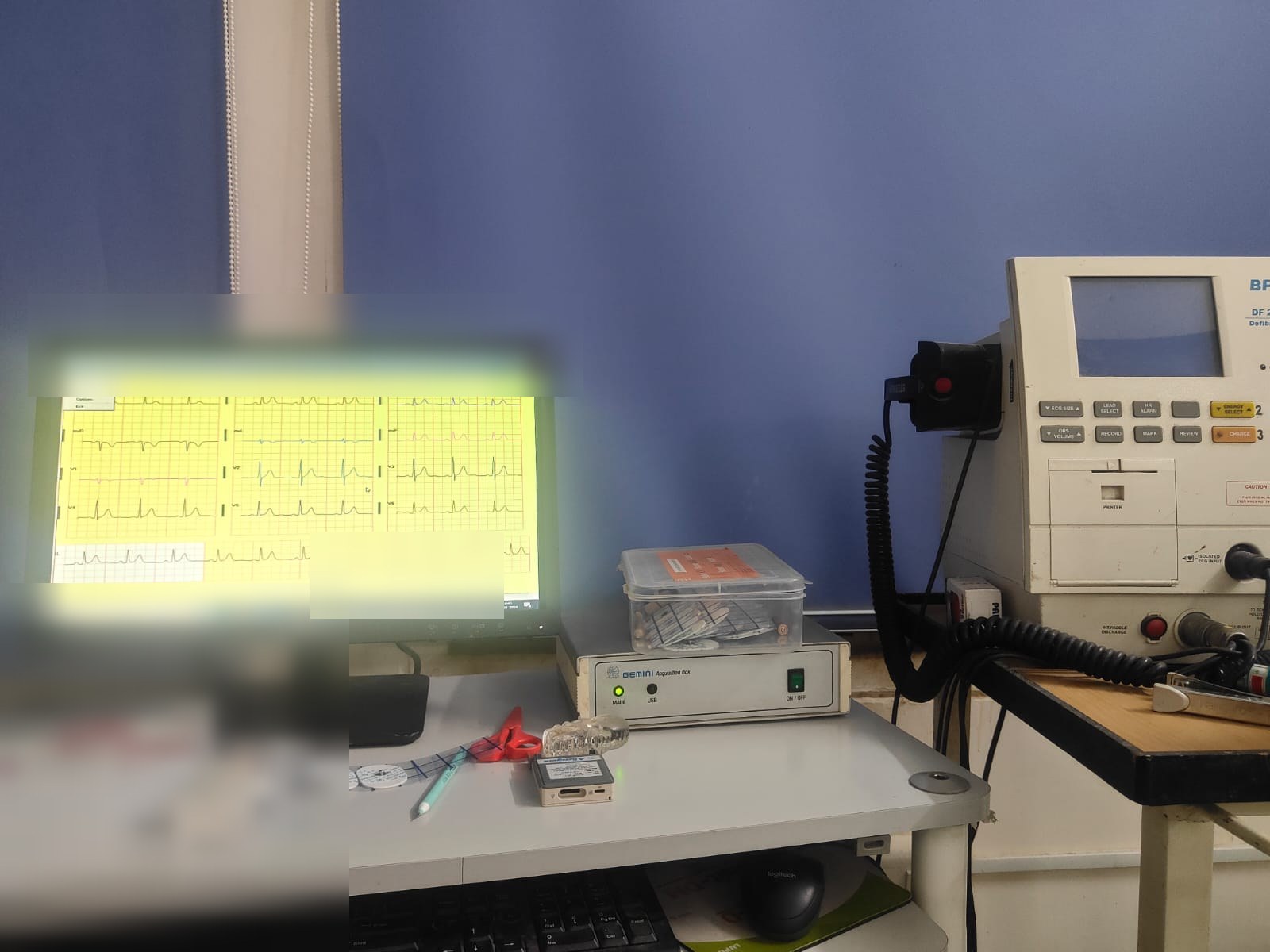 Digital ECG equipment at Spandan Heart and Medicare Clinic