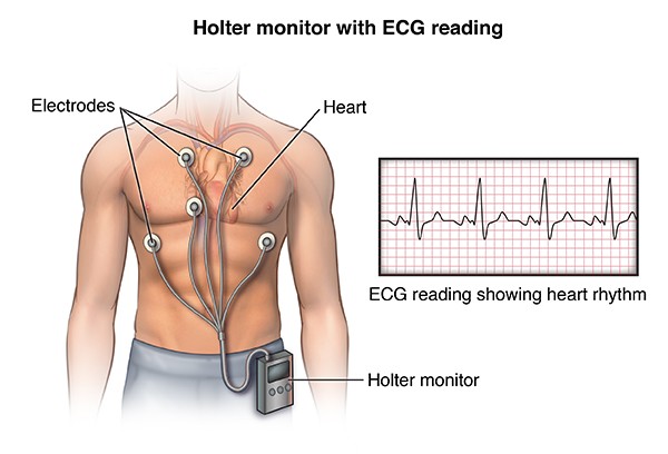 Holter monitor with ECG reading illustration